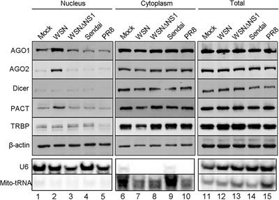 Altering Intracellular Localization of the RNA Interference Factors by Influenza A Virus Non-structural Protein 1